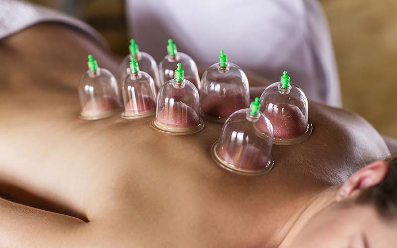 cupping mfd 98223927
